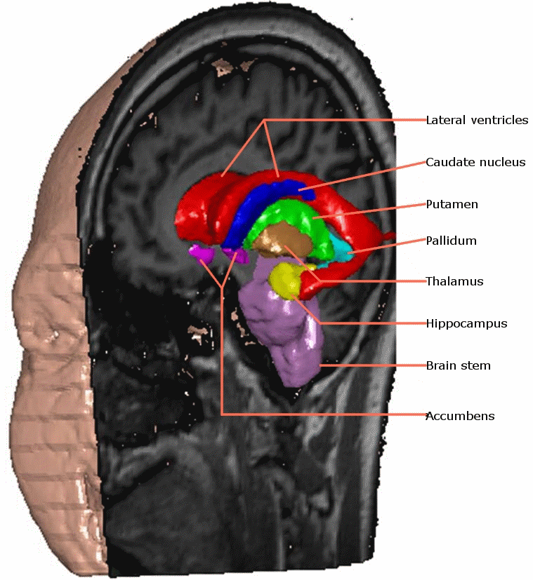 Annotated image of the head showing subcortical structures