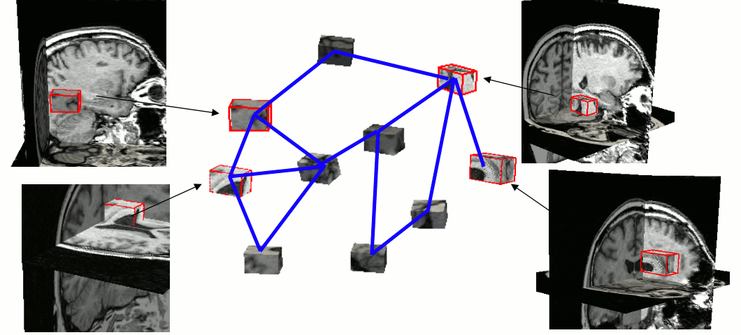 Illustration of a parts-and-geometry model in a brain MR scan