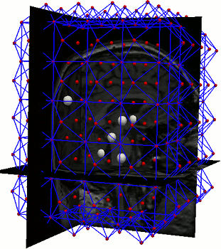 A parts-and-geometry model superimposed on the registration control points in a MR image of the head