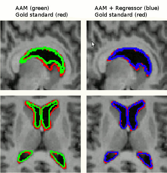 Image comparing results obtained by AAM with those obtained by AAM after post-processing with the regressor