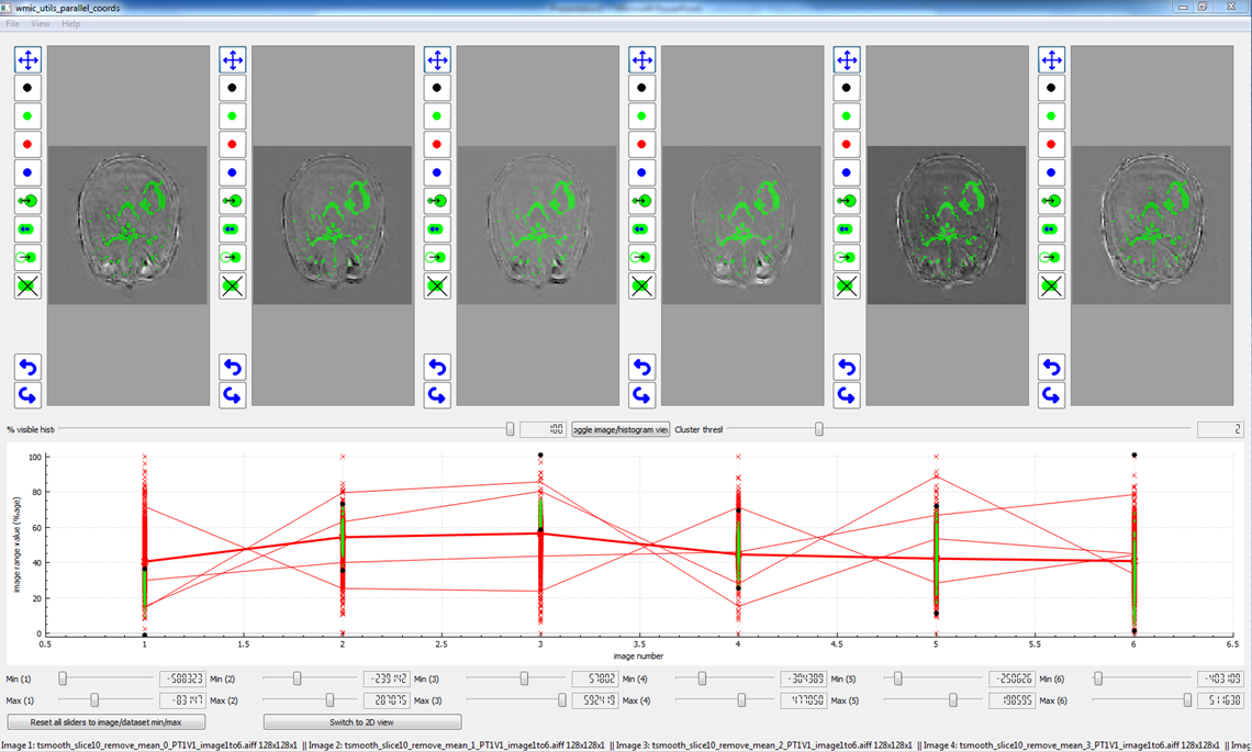 Parallel coordinate software with oxygen-enhanced MRI