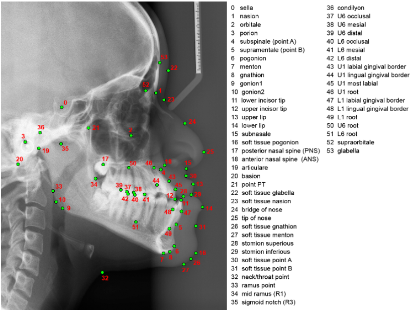 Fully Automatic System For Accurate Localisation And 48 OFF