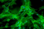 Fluorescence image of fibroblasts in nanofibrous gel