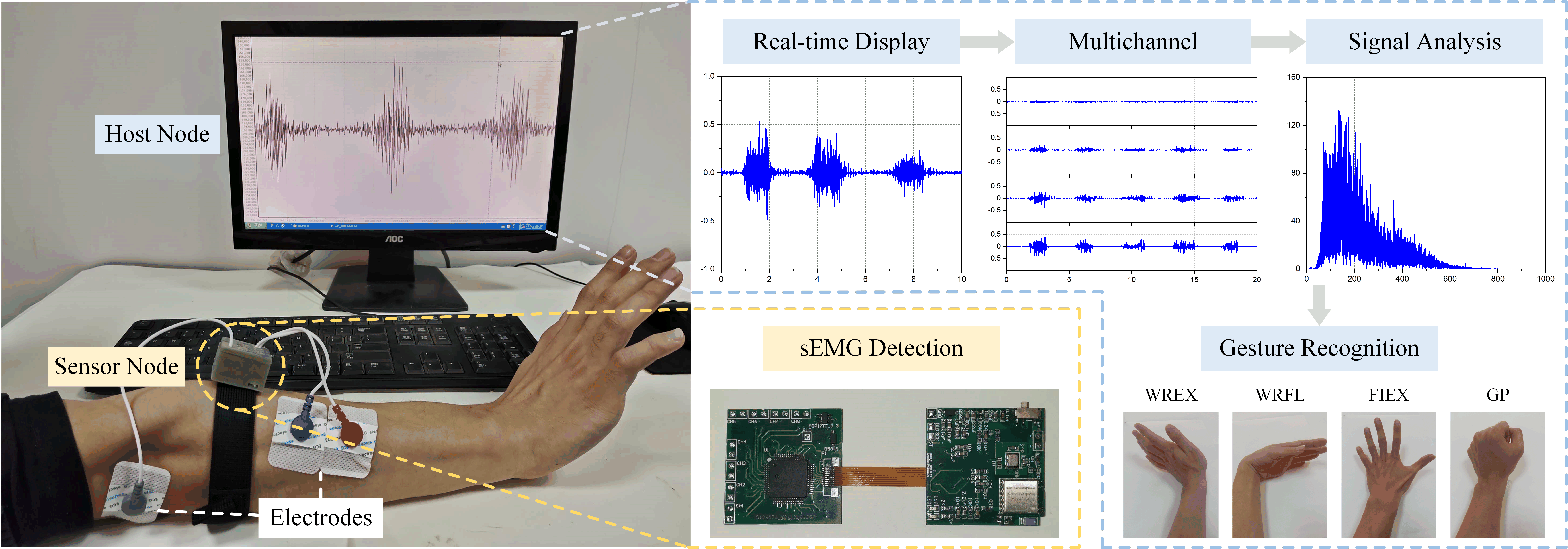 EMG Sensor