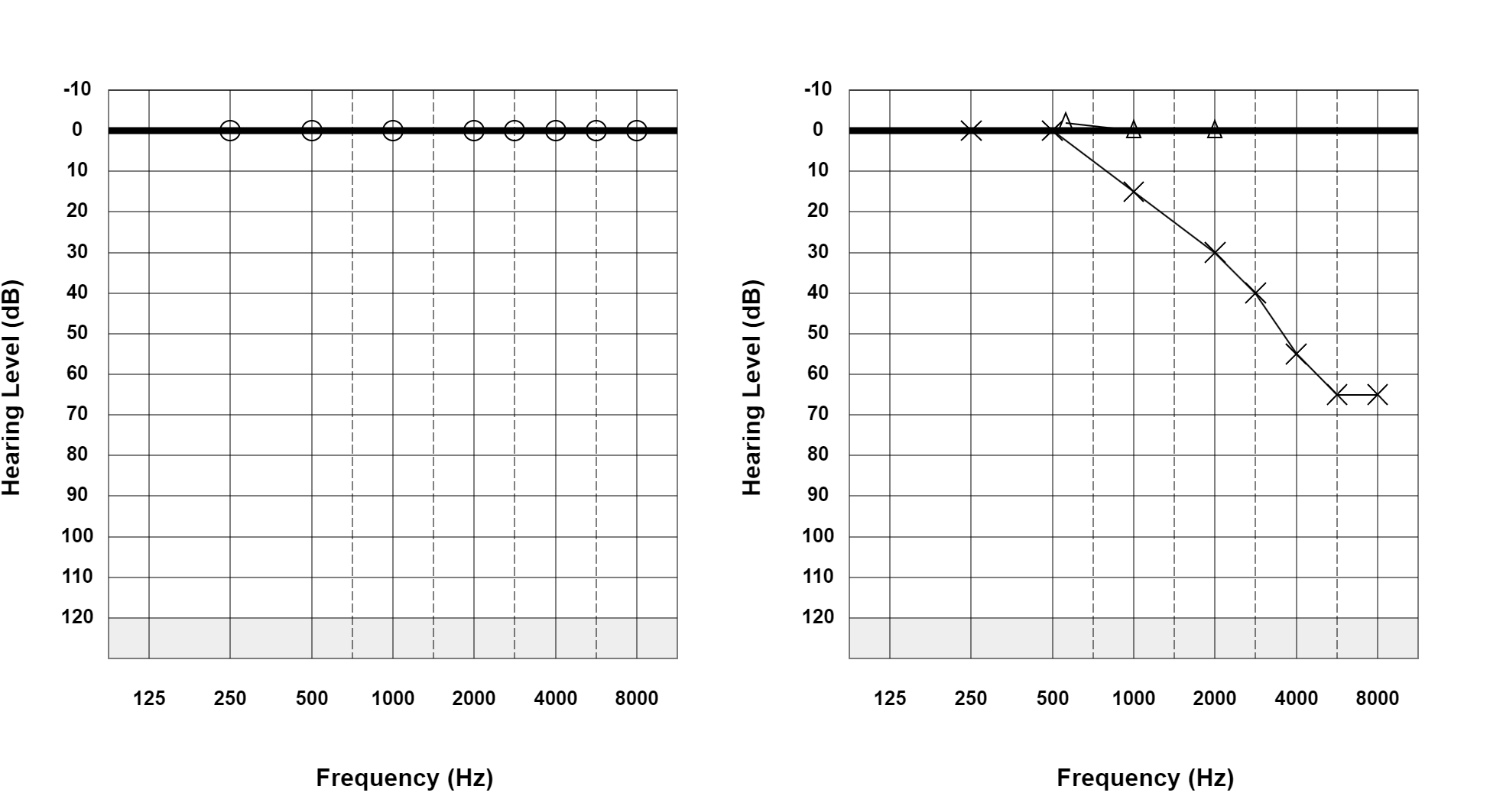 Case 05: supplied not-masked AC and BC audiogram