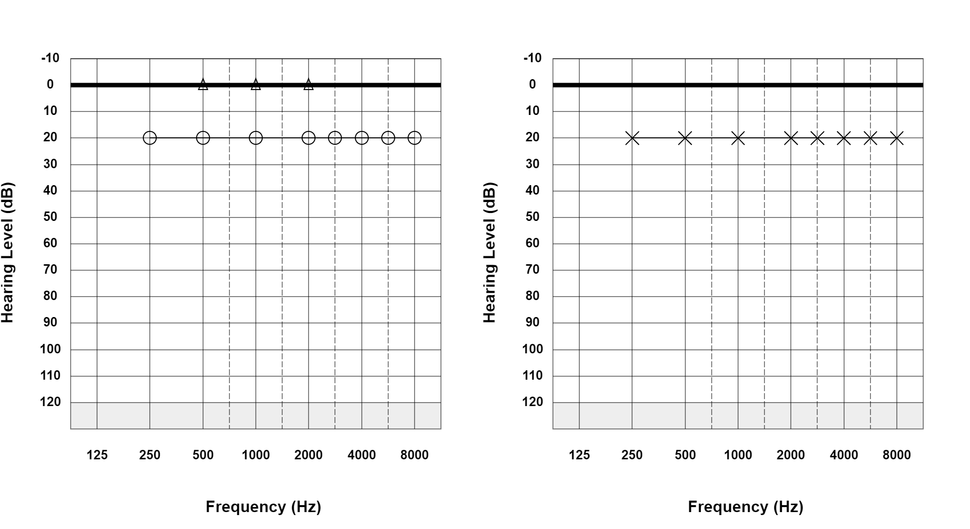 Case 06: supplied not-masked AC and BC audiogram