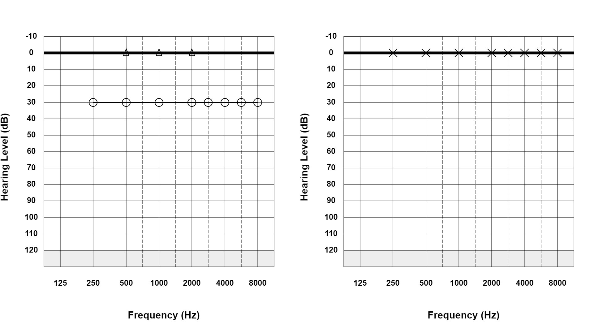 Case 07: supplied not-masked AC and BC audiogram