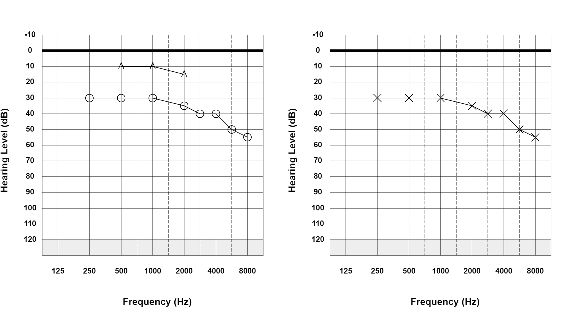 Case 08: supplied not-masked AC and BC audiogram