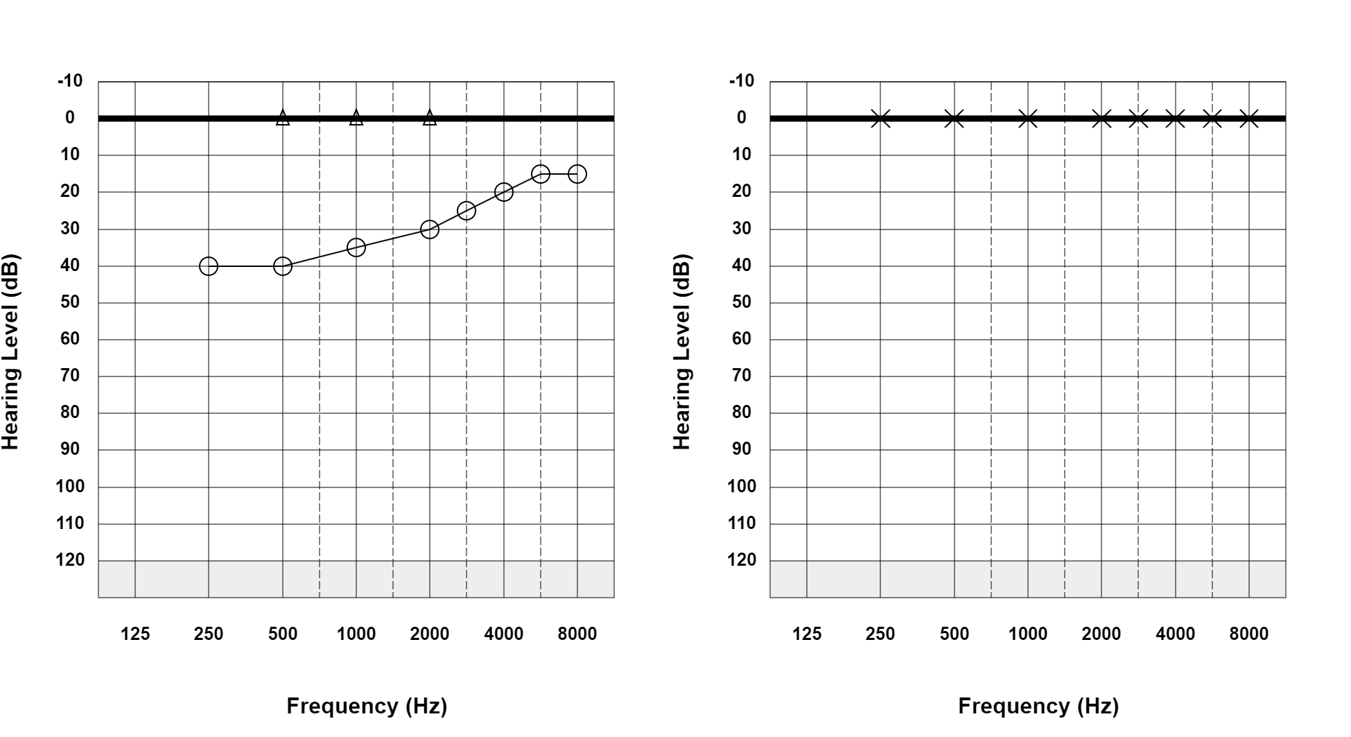 Case 09: supplied not-masked AC and BC audiogram