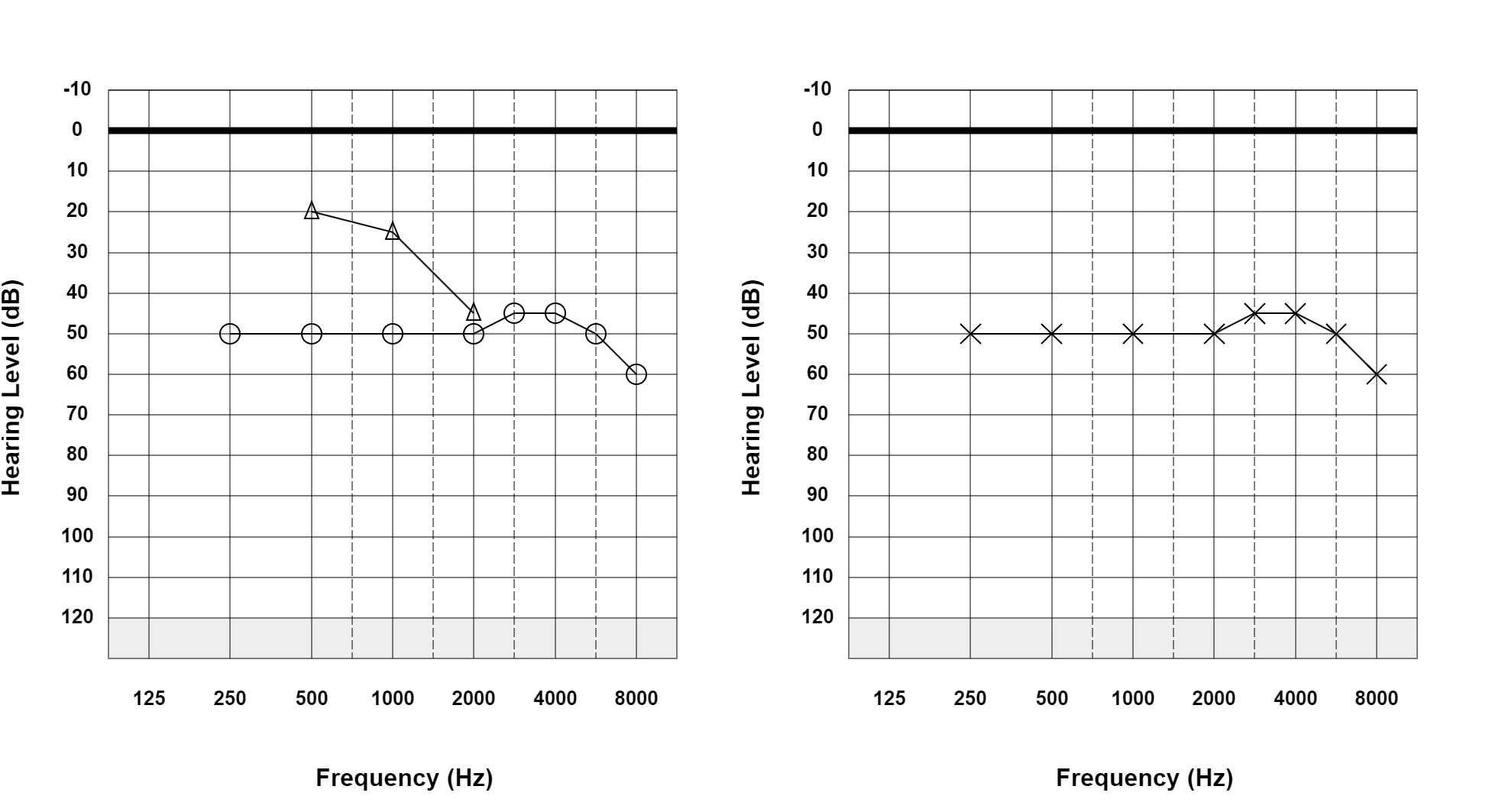 Case 10: supplied not-masked AC and BC audiogram