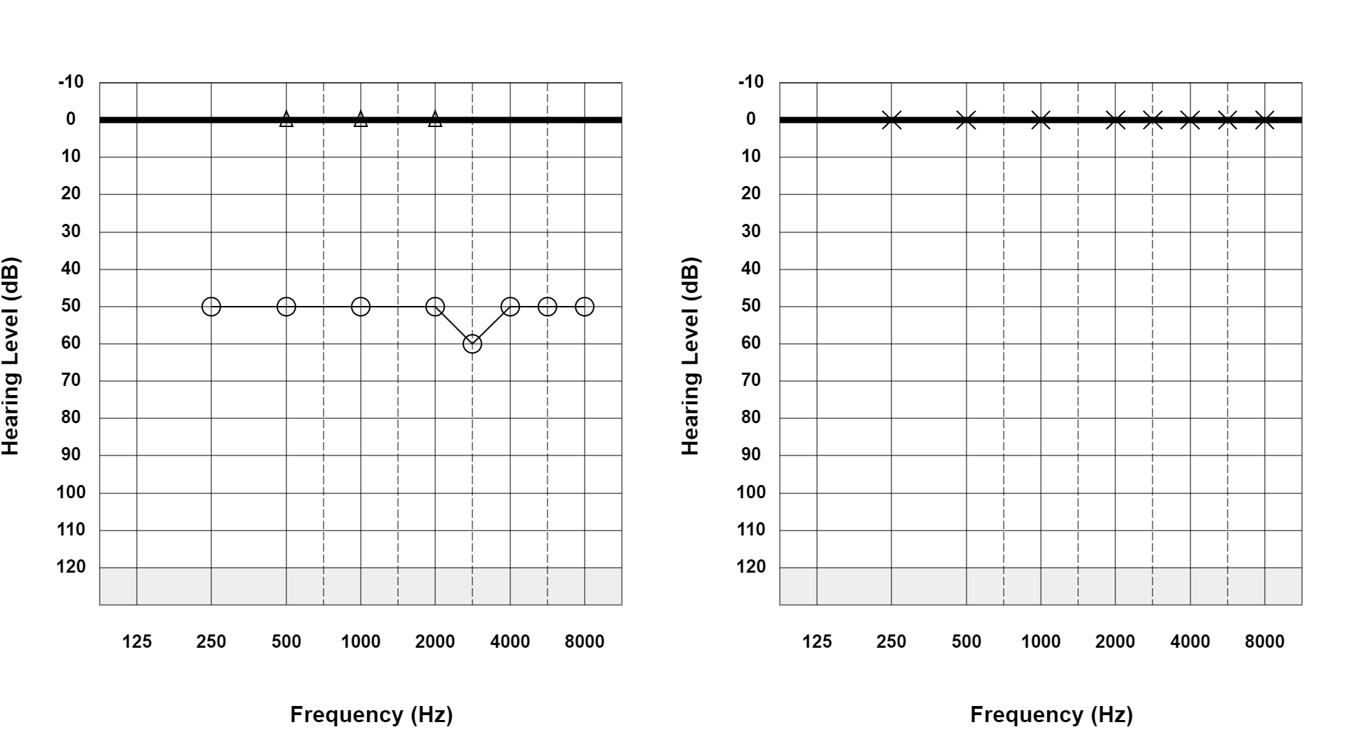 Case 21: supplied not-masked AC and BC audiogram