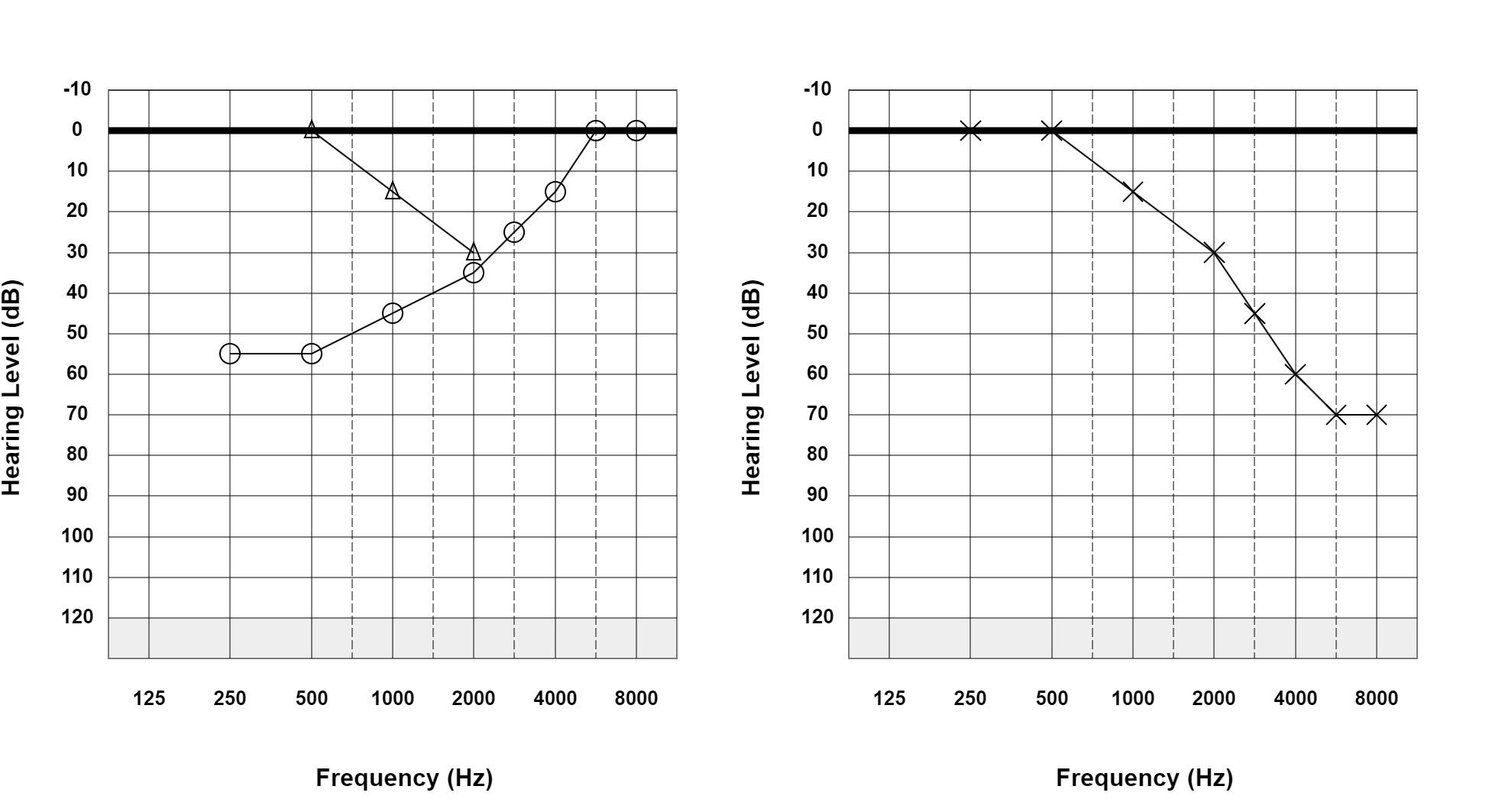 Case 23: supplied not-masked AC and BC audiogram