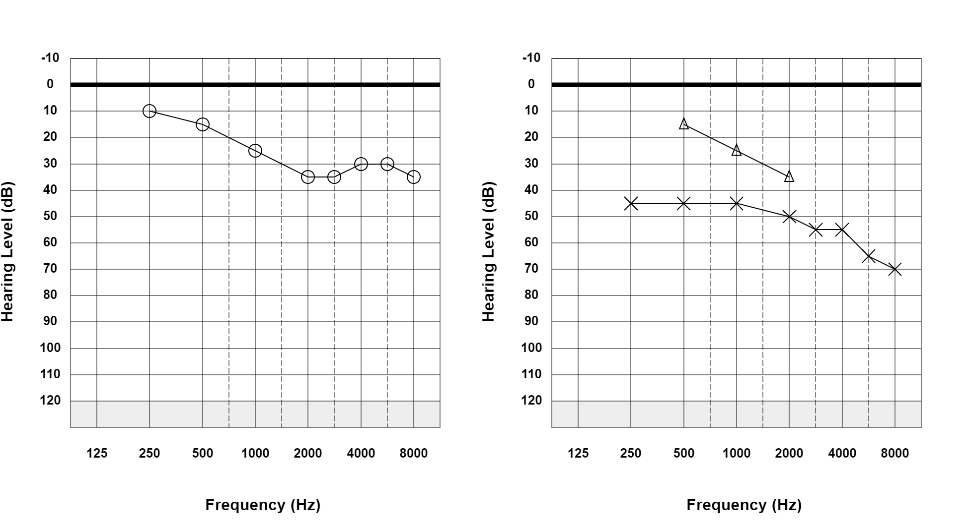 Case 24: supplied not-masked AC and BC audiogram