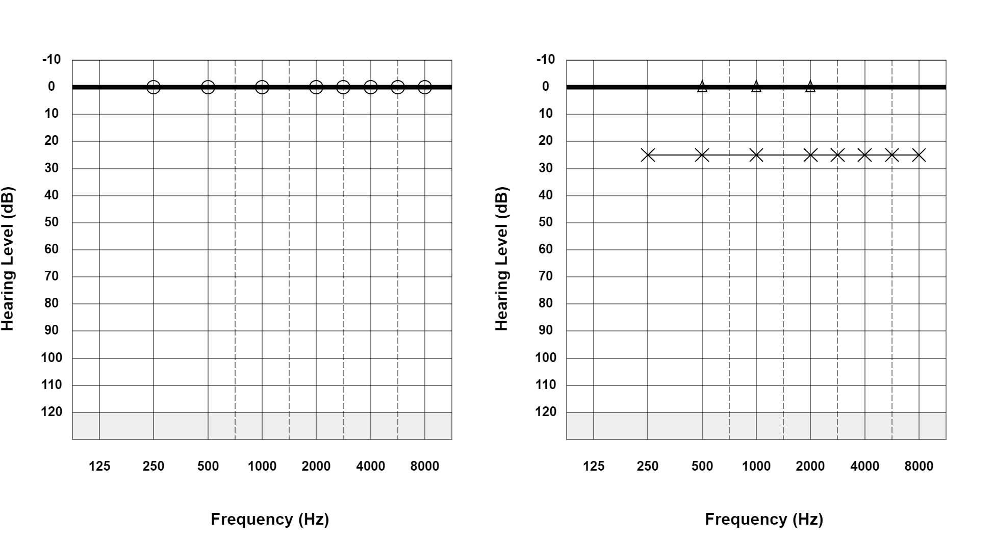 Case 26: supplied not-masked AC and BC audiogram