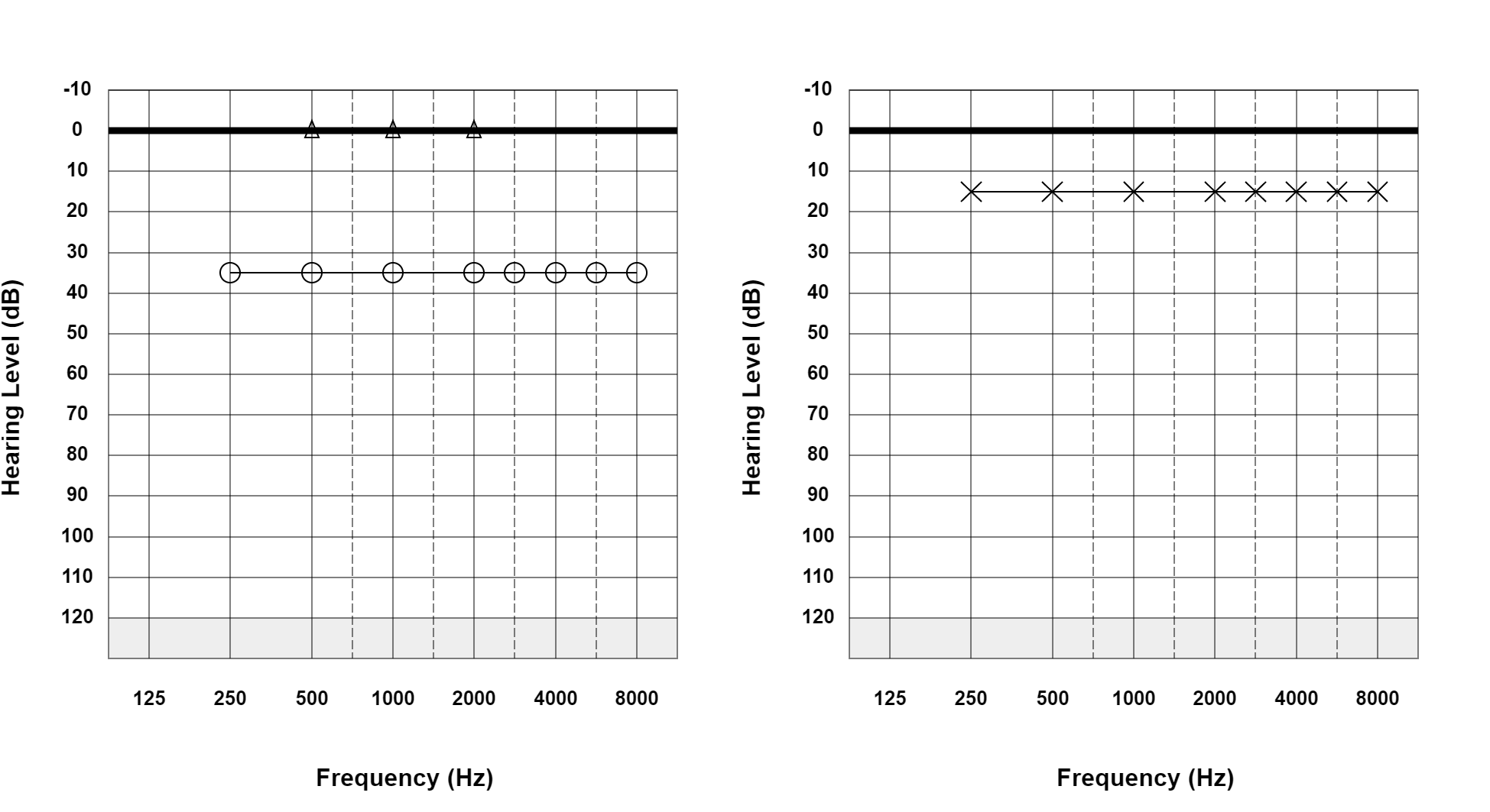 Case 27: supplied not-masked AC and BC audiogram
