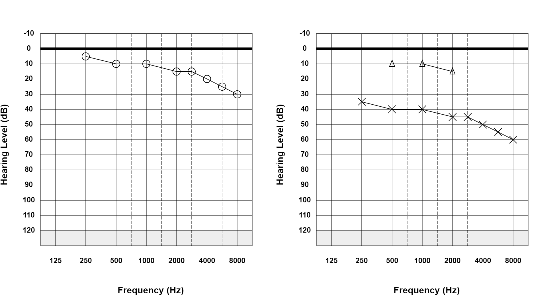 Case 28: supplied not-masked AC and BC audiogram