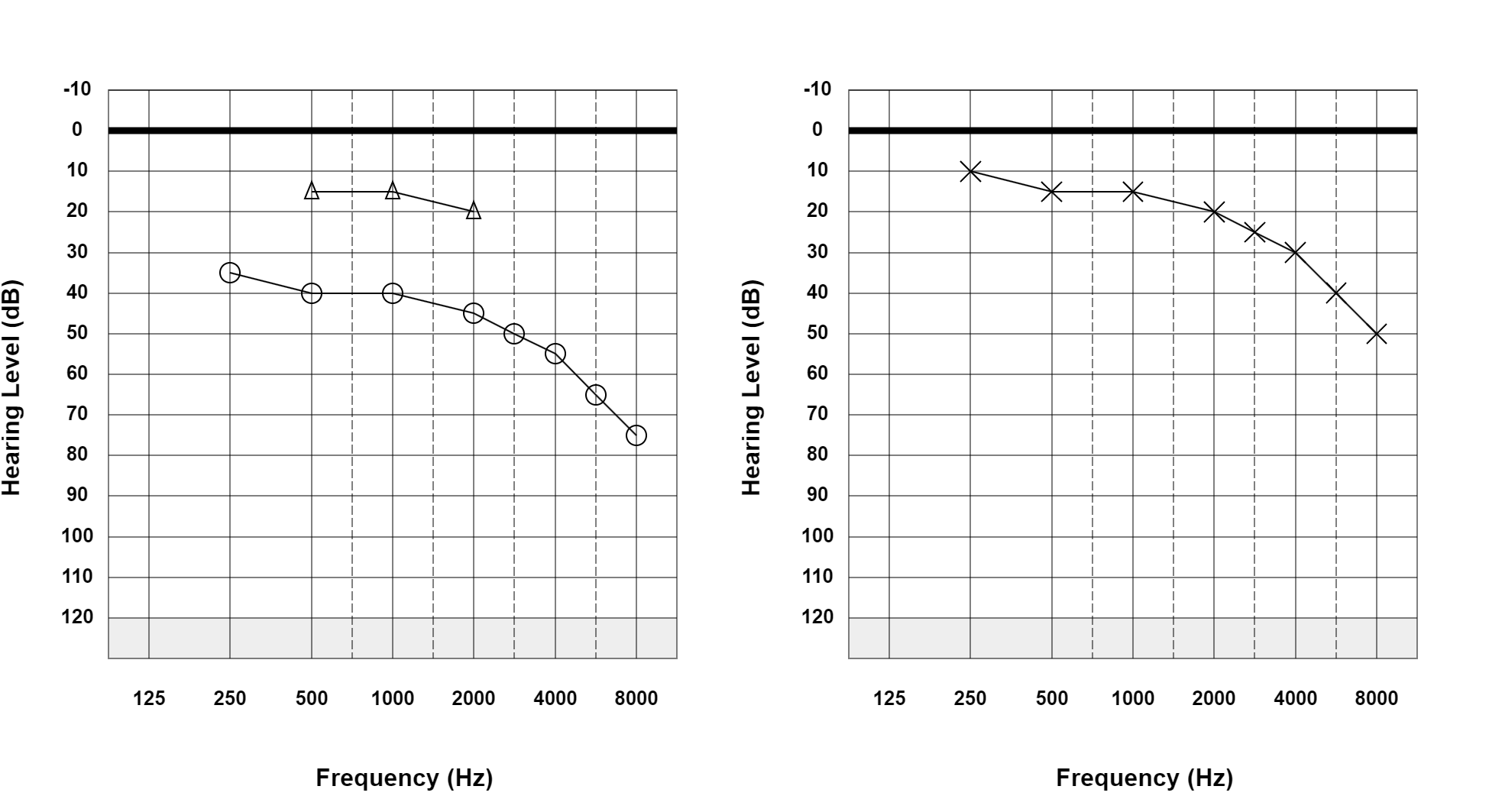 Case 29: supplied not-masked AC and BC audiogram