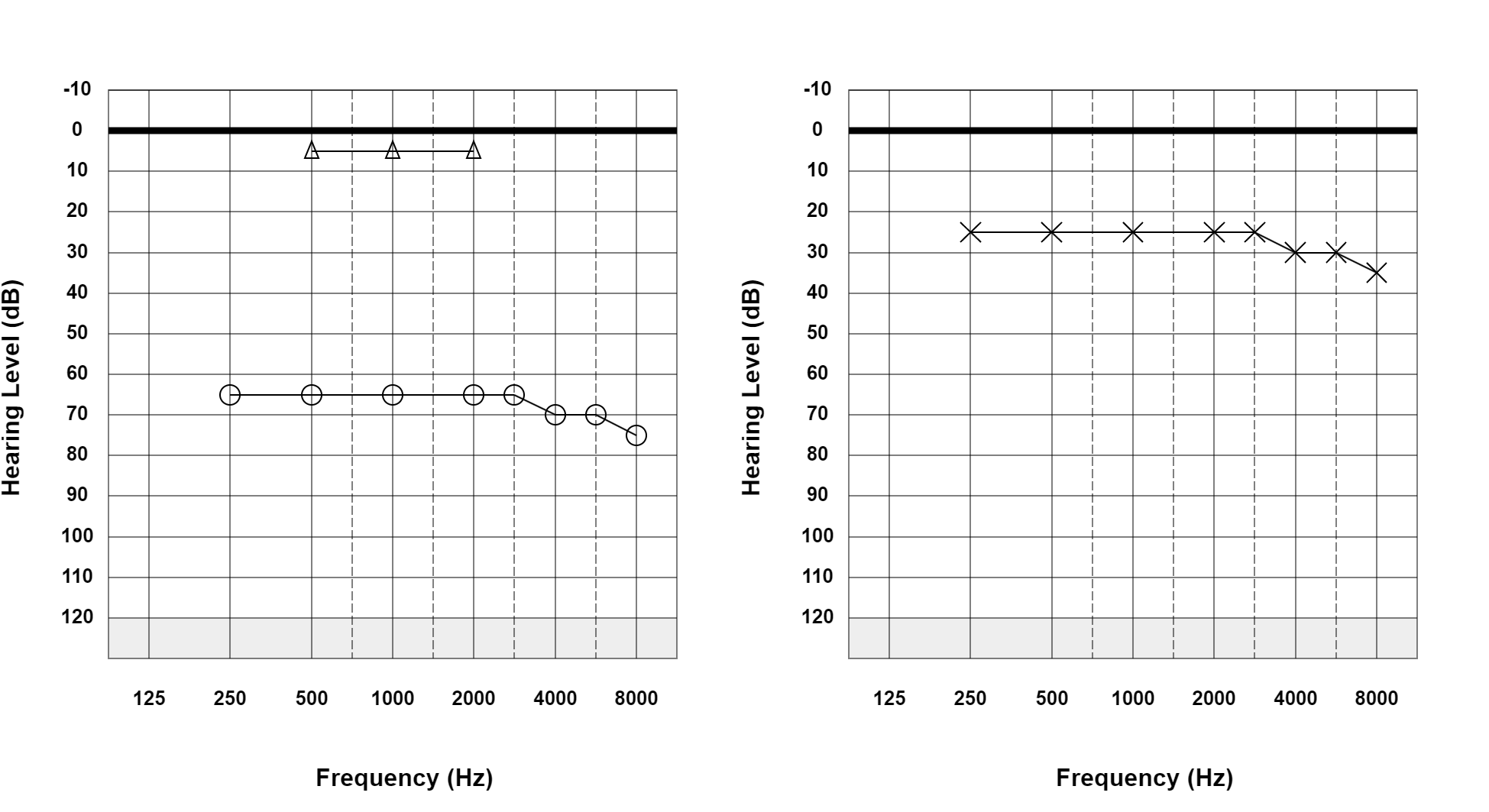 Case 30: supplied not-masked AC and BC audiogram