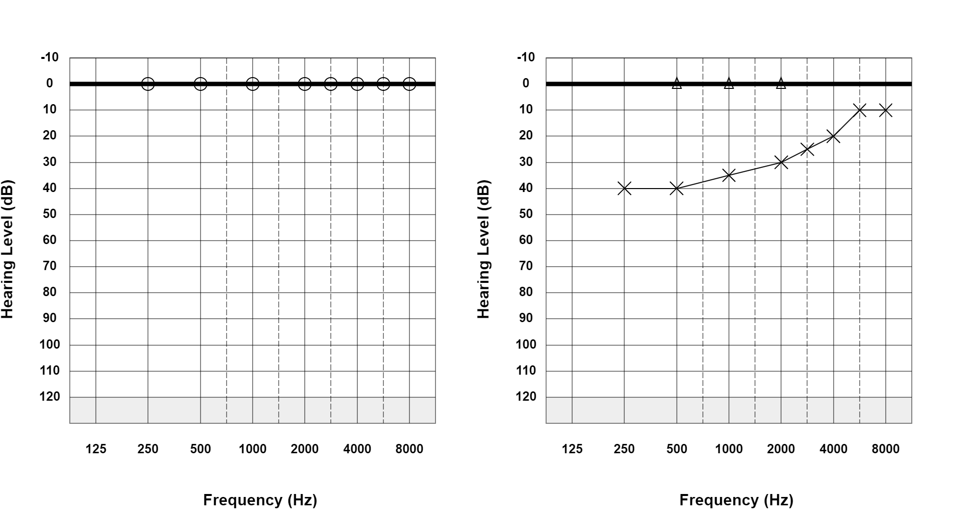 Case 31: supplied not-masked AC and BC audiogram