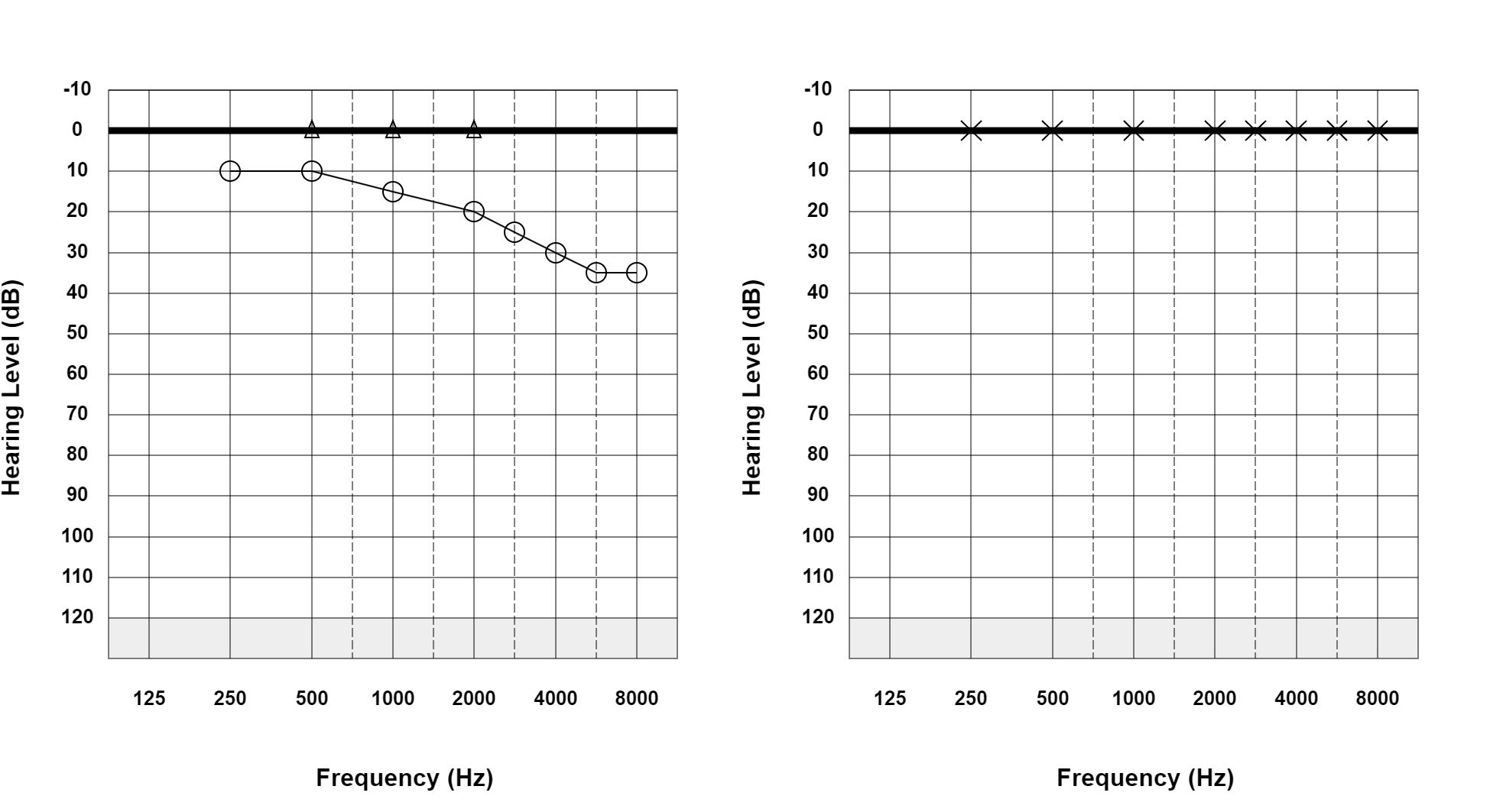 Case 32: supplied not-masked AC and BC audiogram