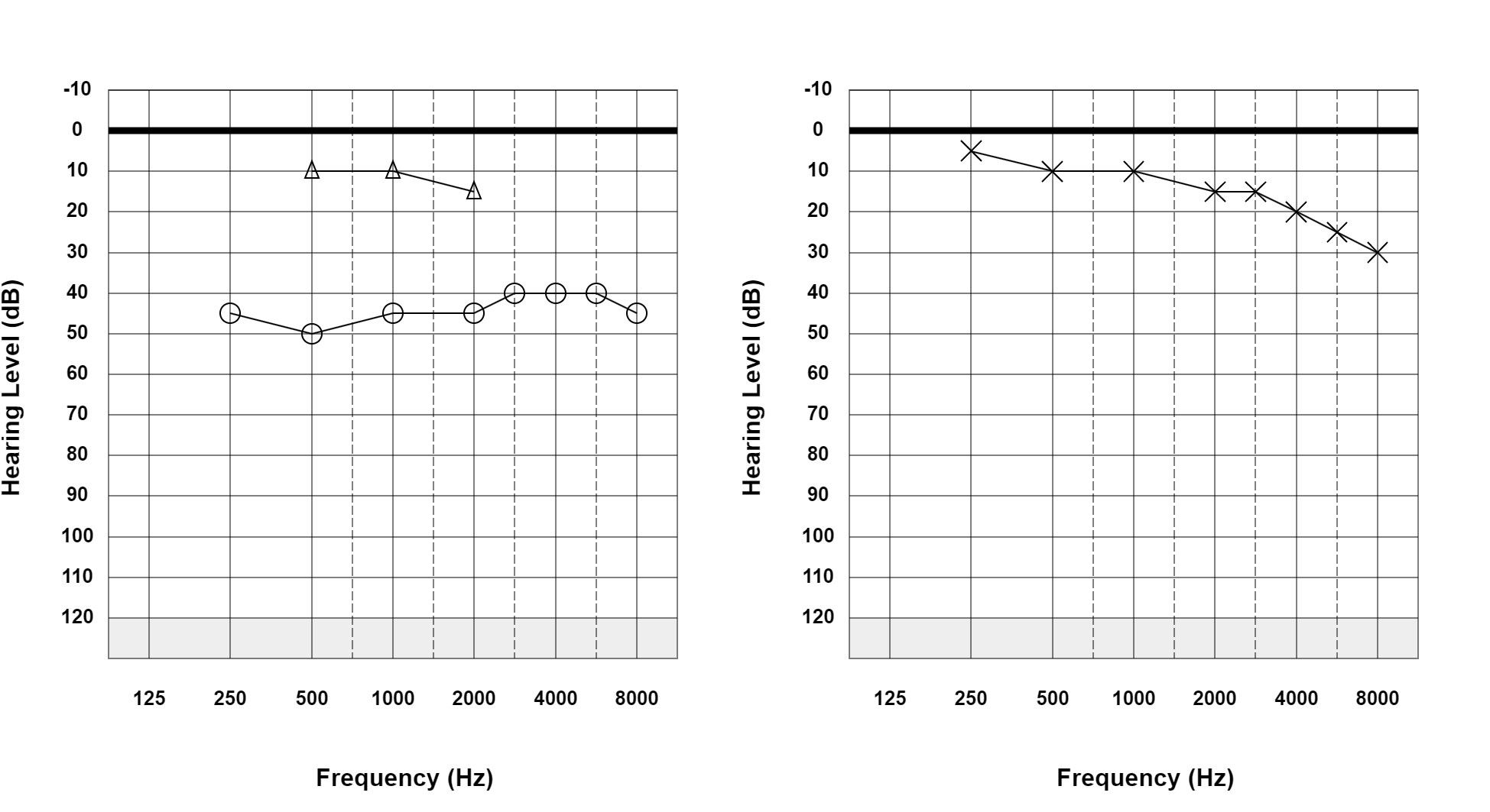 Case 34: supplied not-masked AC and BC audiogram