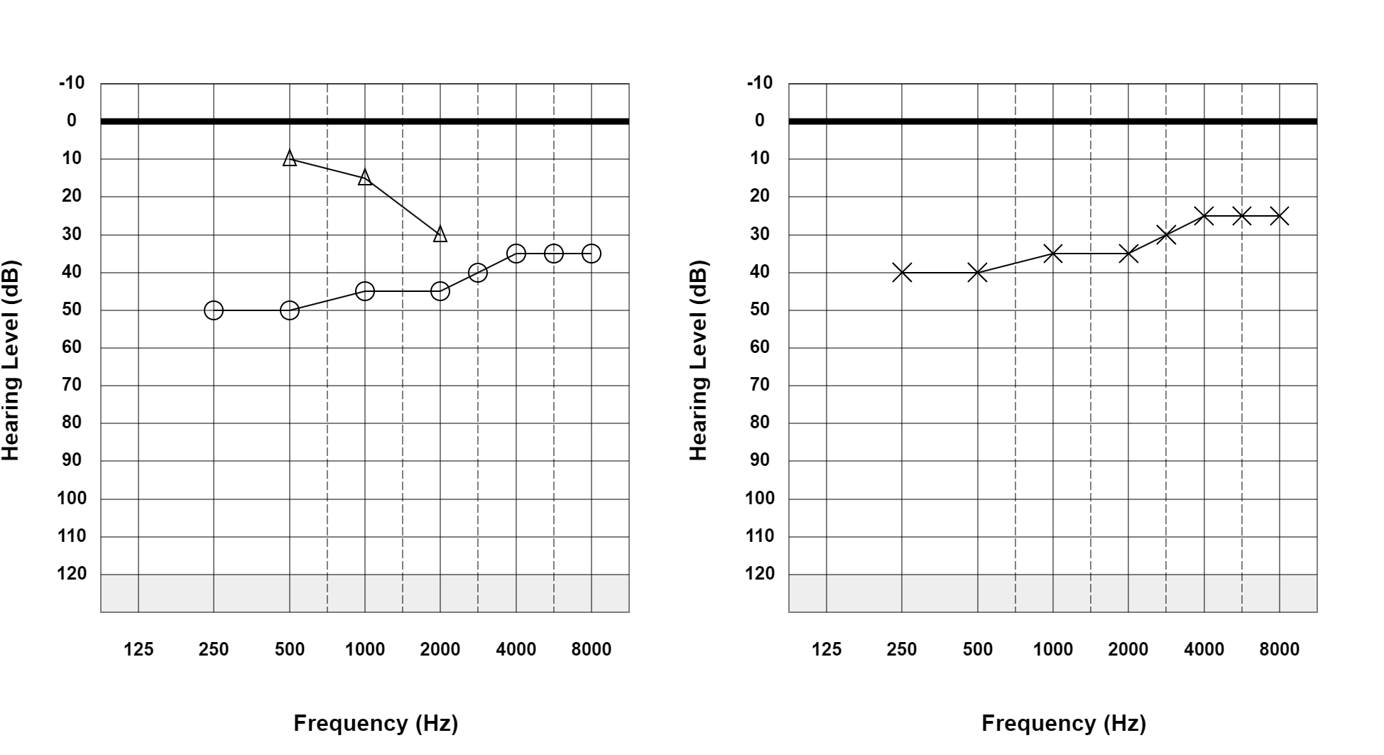 Case 35: supplied not-masked AC and BC audiogram